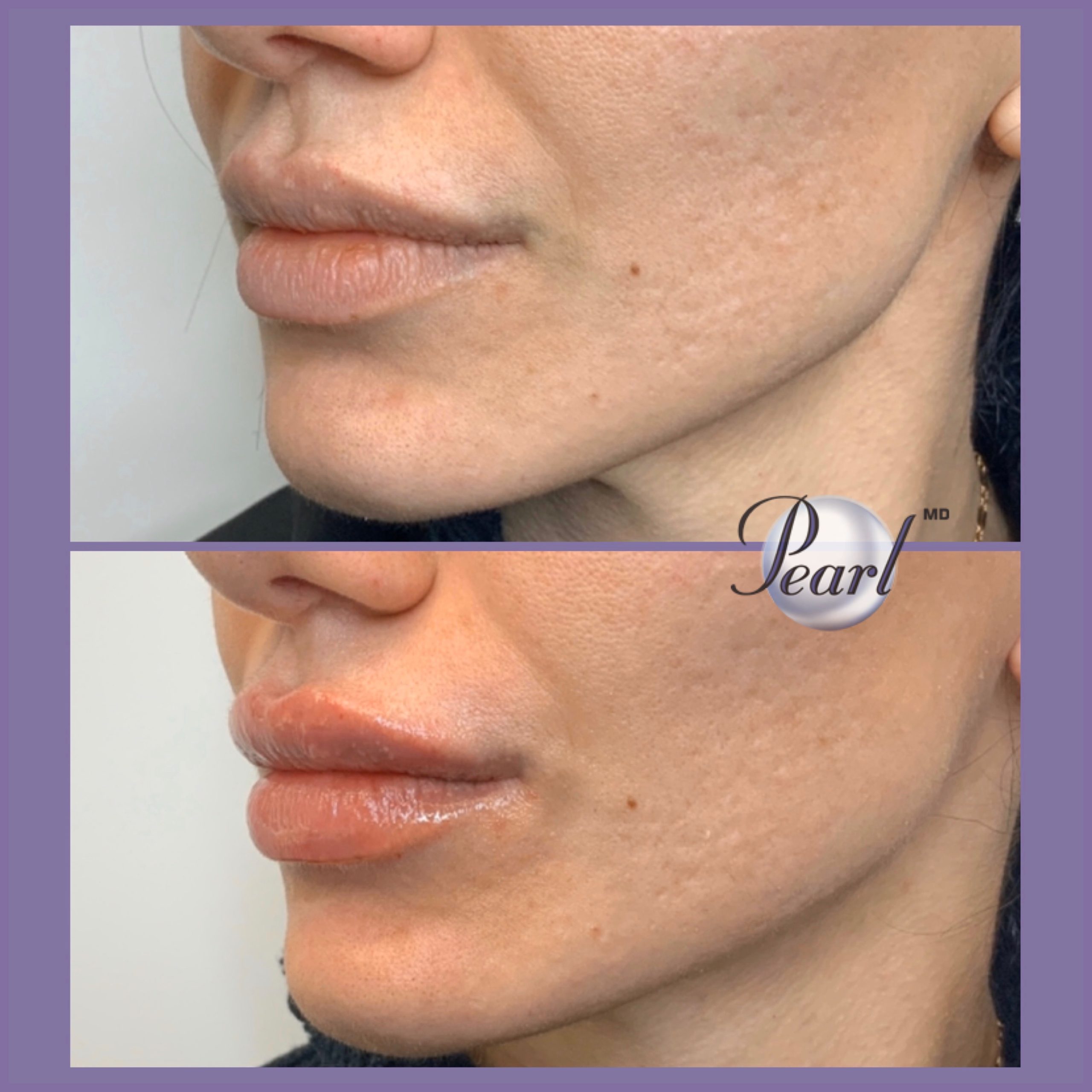 , Injectables and Dermal Fillers