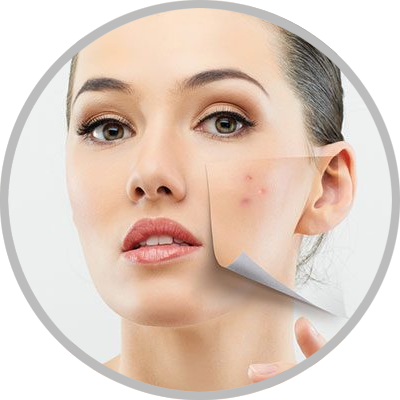 , Skin Rejuvenation Procedures